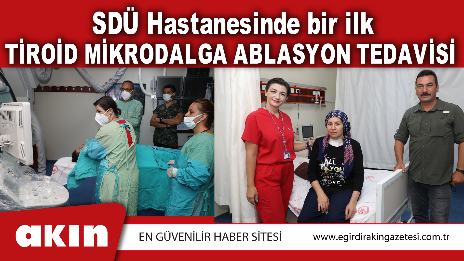 SDÜ Hastanesinde bir ilk TİROİD MİKRODALGA ABLASYON TEDAVİSİ