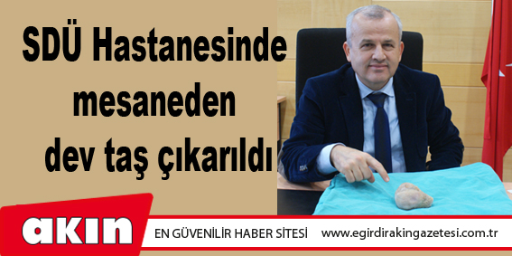 SDÜ Hastanesinde mesaneden dev taş çıkarıldı