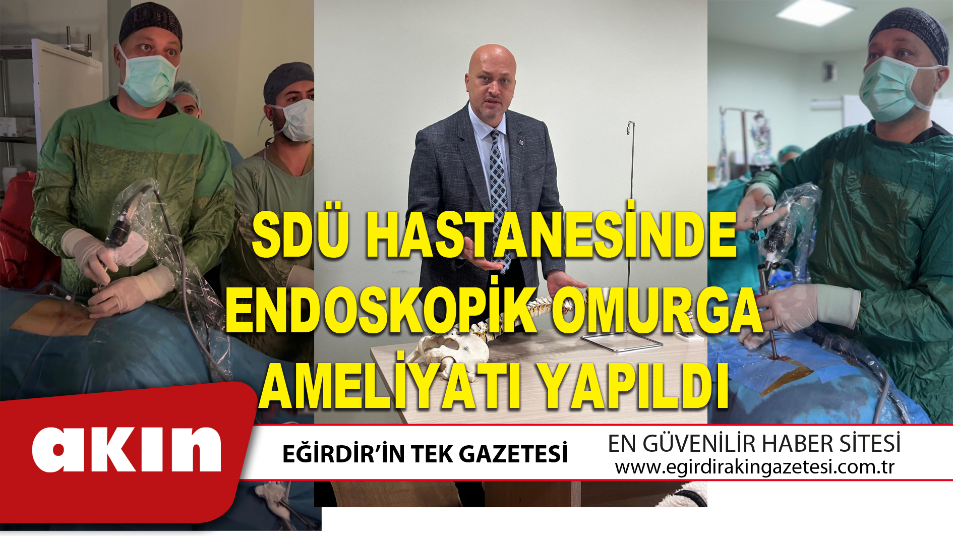 SDÜ HASTANESİNDE ENDOSKOPİK OMURGA AMELİYATI YAPILDI