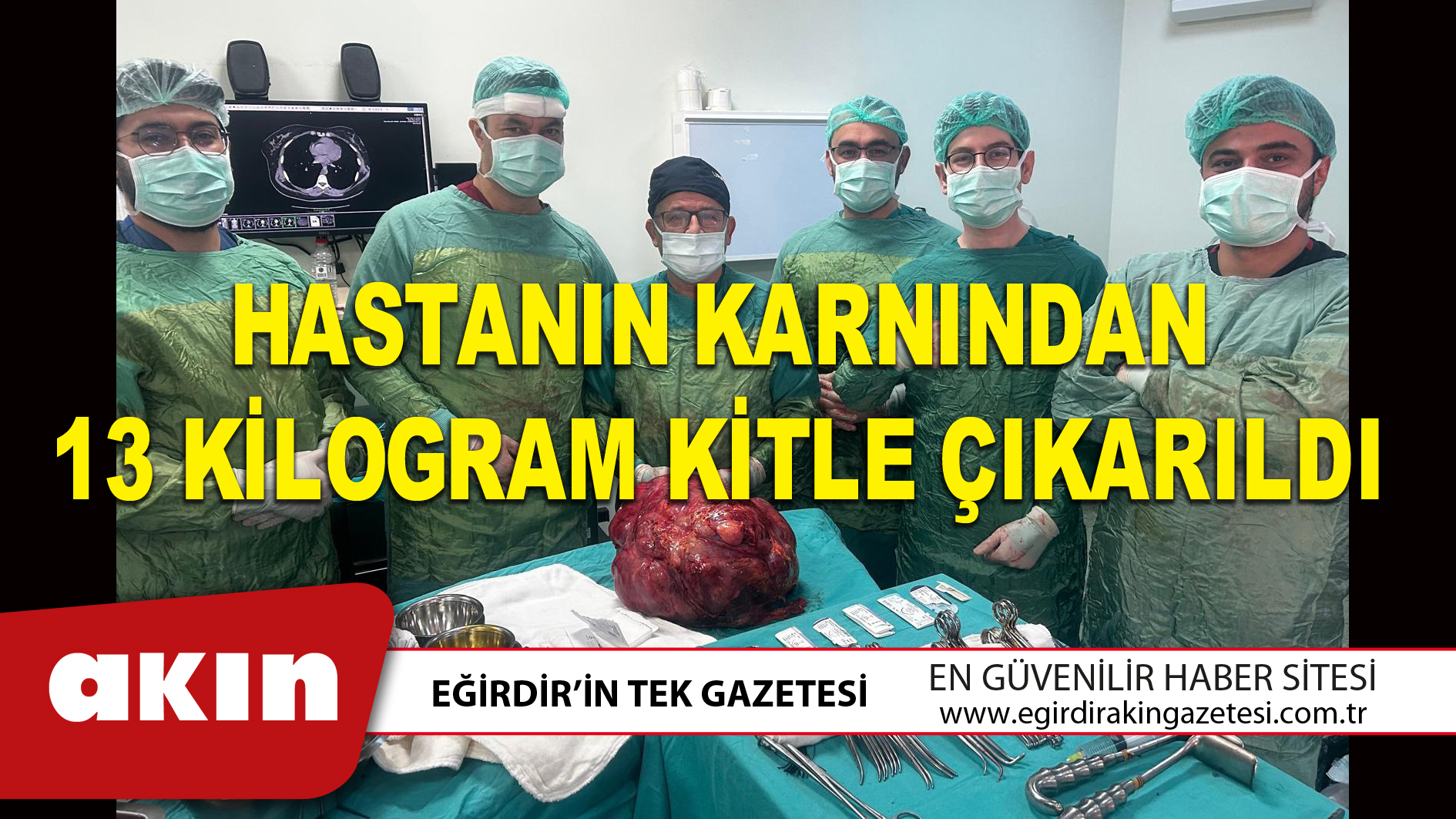 HASTANIN KARNINDAN 13 KİLOGRAM KİTLE ÇIKARILDI