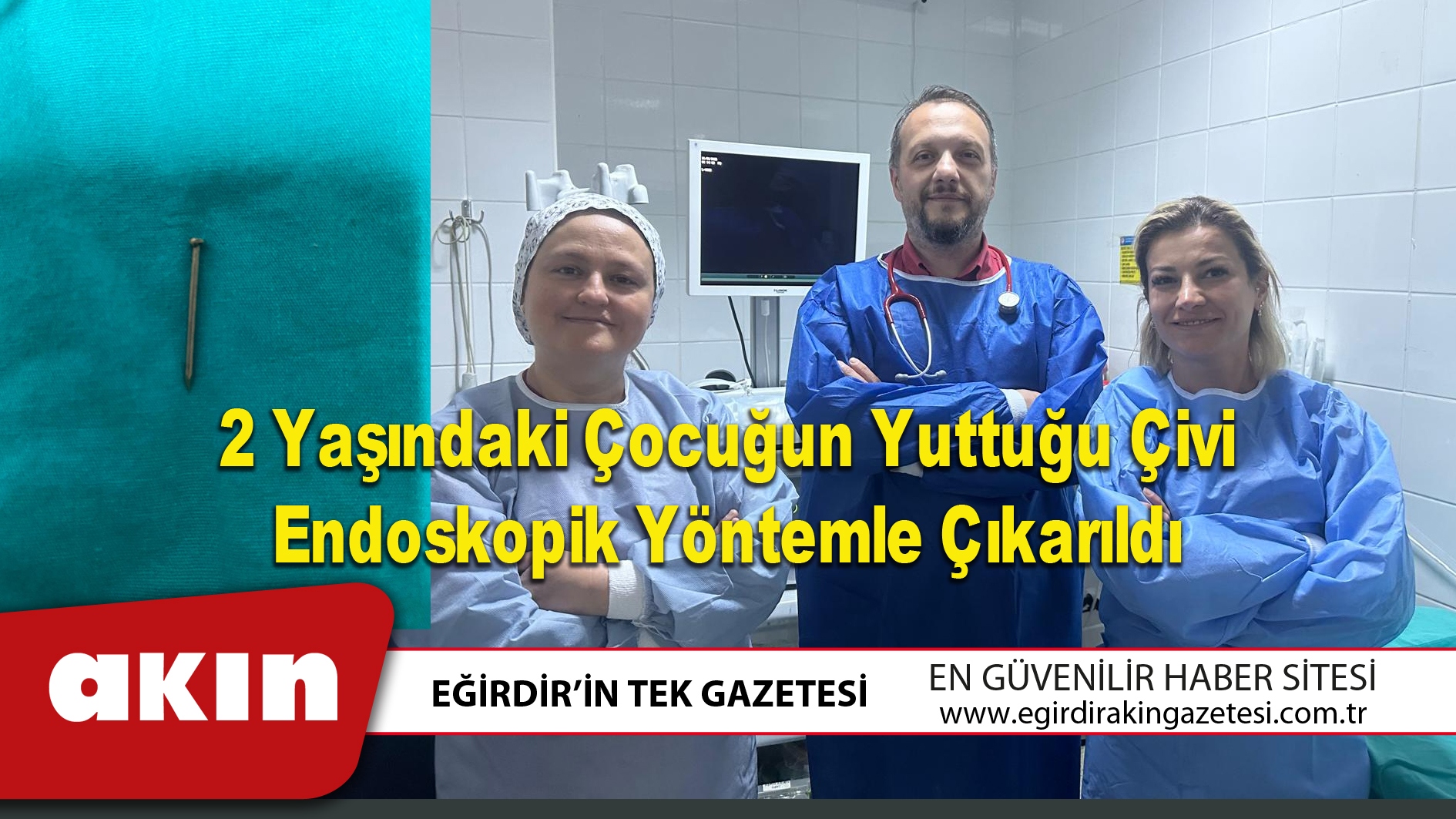 eğirdir haber,akın gazetesi,egirdir haberler,son dakika,2 Yaşındaki Çocuğun Yuttuğu Çivi Endoskopik Yöntemle Çıkarıldı